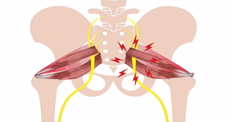SciatiEase - Supports Sciatic Nerve Health